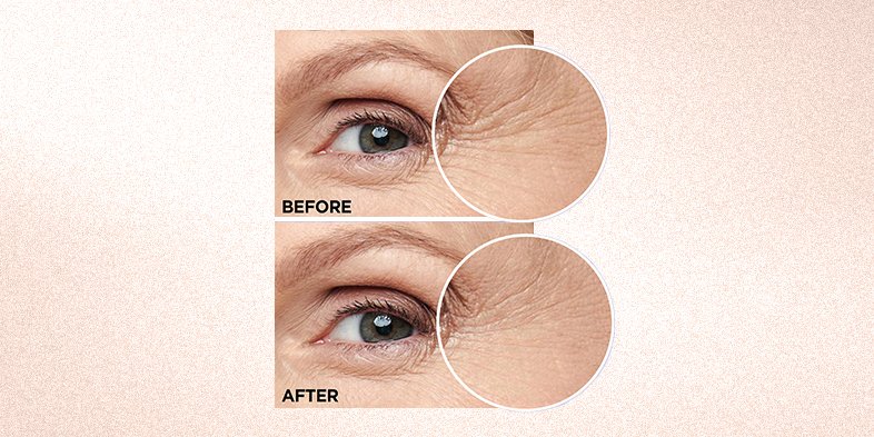 In Article Hydrated Skin 15 Hyaluronic Acid 1 Caffeine